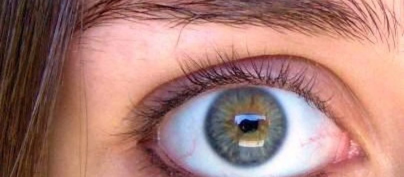 Όλα όσα πρέπει να γνωρίζετε για το γλαύκωμα: Συμπτώματα και αντιμετώπιση (φώτο)